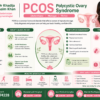 PCOS treatment consultation with gynecologist