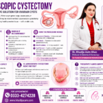 Laparoscopic Cystectomy in Lahore Dr. Khadija Khan